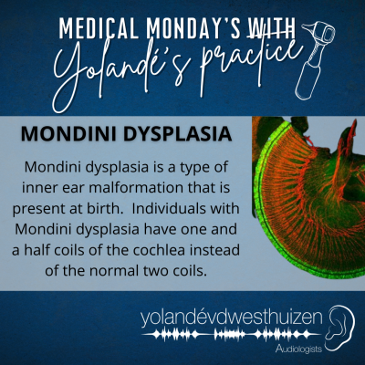 YvDW Audiologists - Medical Mondays - Mondini Dysplasia