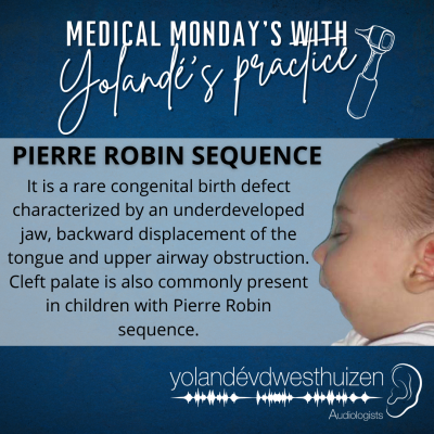YvDW Audiologists - Medical Mondays - Pierre Robin Sequence