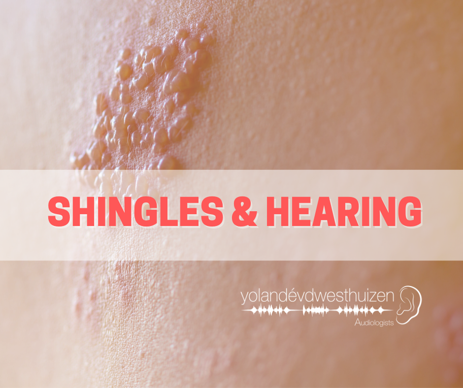 Shingles & Hearing Loss