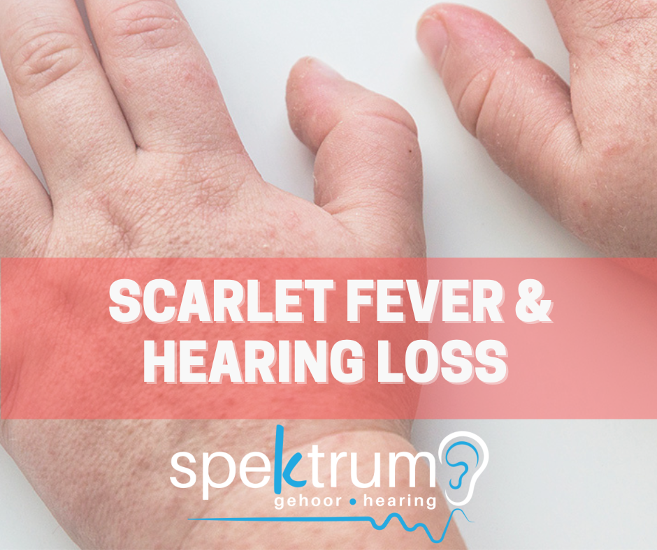 Scarlet Fever can cause hearing loss