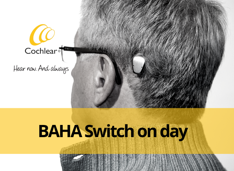 BAHA Switch on day