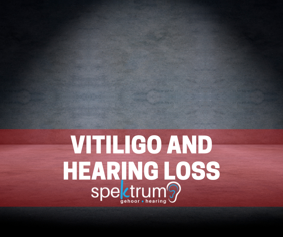Vitiligo and hearing loss